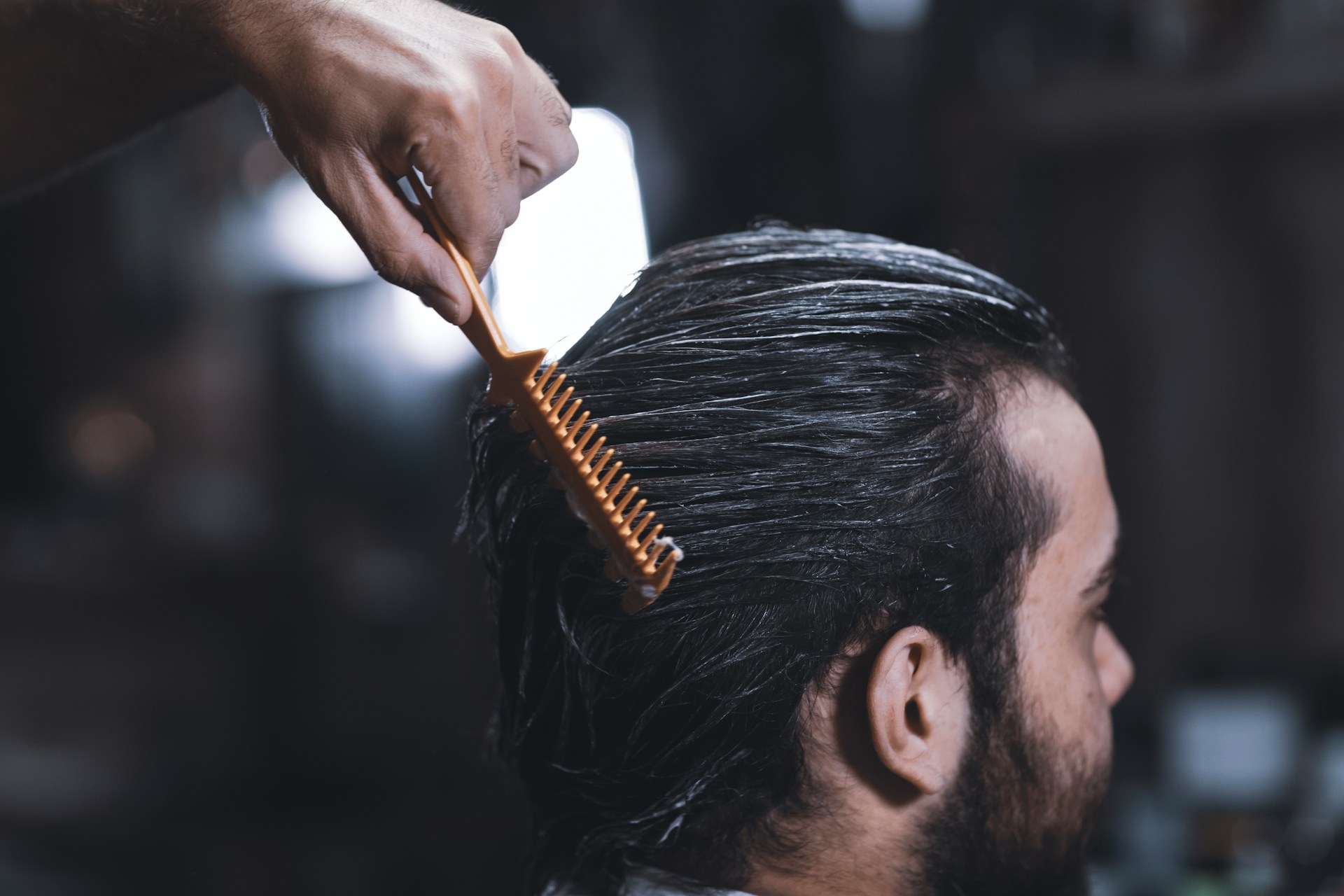 haartransplantatie Nederland