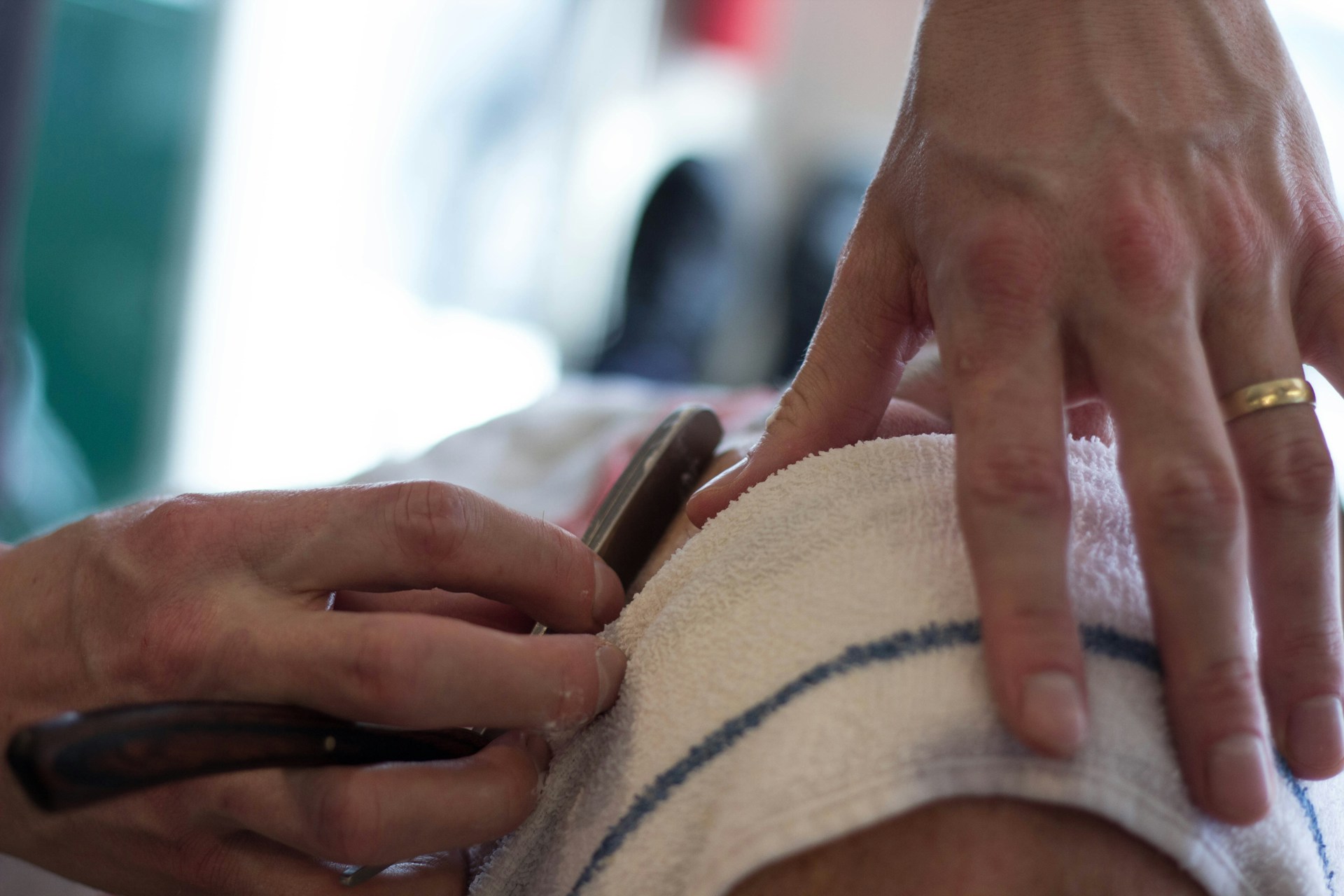 microneedling ervaringen